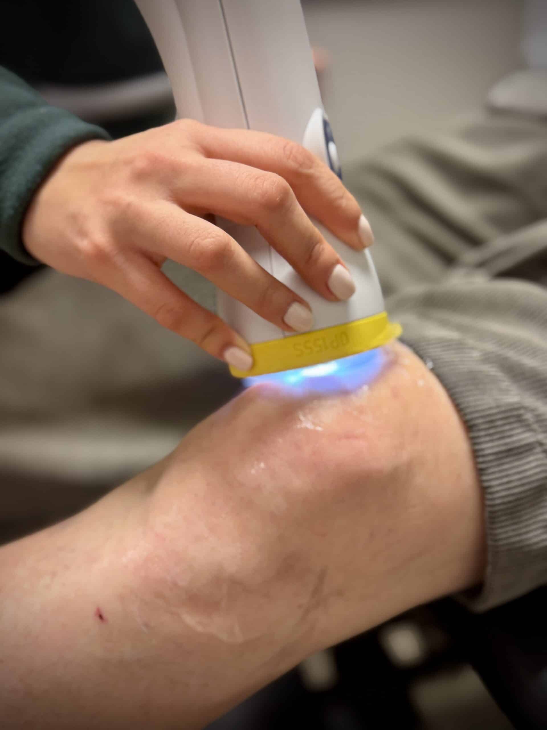 SoftWave therapy treatment at Life Source Chiropractic in Omaha